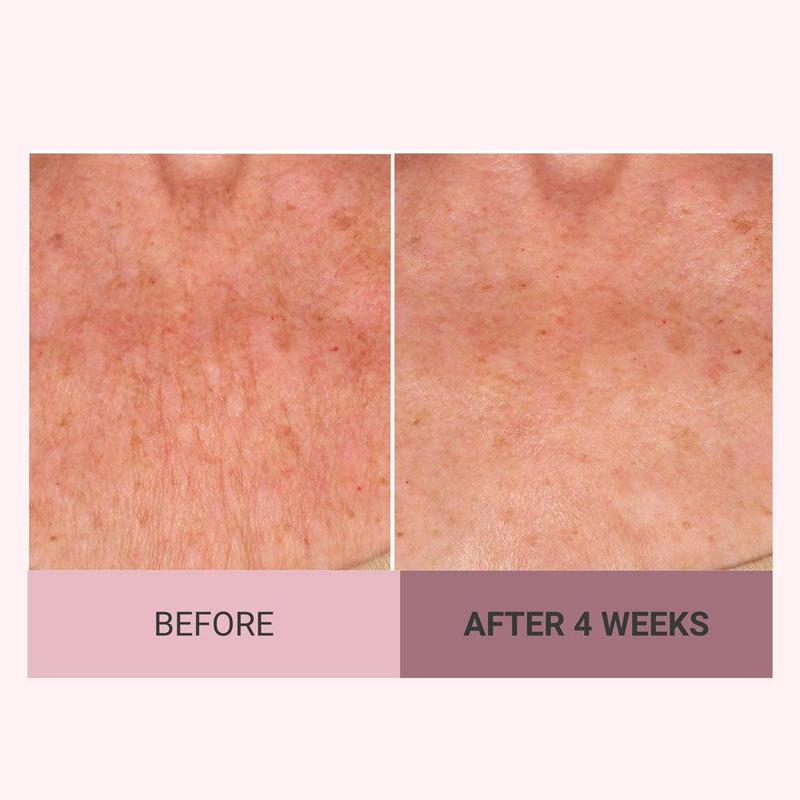 💆♀️ Experience Ultimate Luxury - 50% OFF - ✨ Champagne Beaute Lift Firming Body Crème - For Firmer, Smoother, Radiant Skin! 🌟(Buy 3 & Free Shipping)