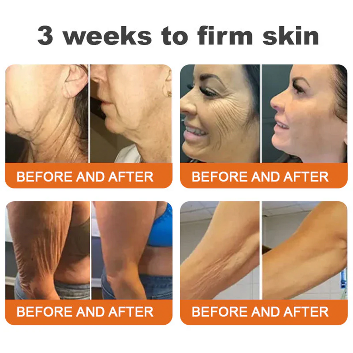 🔥 60% OFF Today Only 🔥 🐝 FDA-Approved BBOJI™ Bee Venom Pro Cream – Clinically Proven to Firm, Lift & Smooth Skin at Any Age 🐝