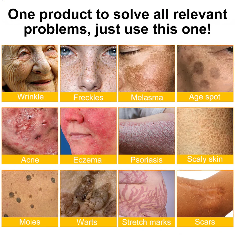 🔥 60% OFF Today Only 🔥 🐝 FDA-Approved BBOJI™ Bee Venom Pro Cream – Clinically Proven to Firm, Lift & Smooth Skin at Any Age 🐝