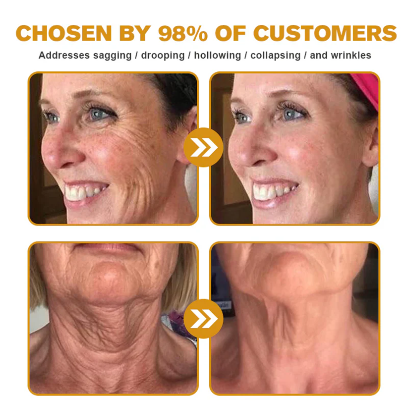 🔥 60% OFF Today Only 🔥 🐝 FDA-Approved BBOJI™ Bee Venom Pro Cream – Clinically Proven to Firm, Lift & Smooth Skin at Any Age 🐝