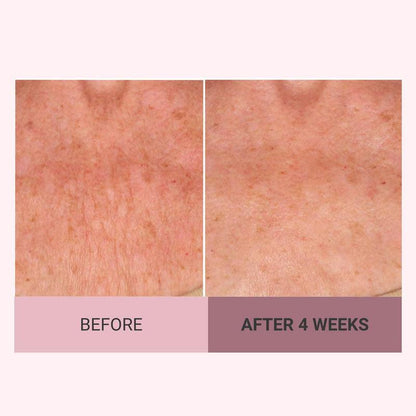 💆‍♀️ Experience Ultimate Luxury - 50% OFF - ✨ Champagne Beaute Lift Firming Body Crème - For Firmer, Smoother, Radiant Skin! 🌟（Buy 3 & Free Shipping）