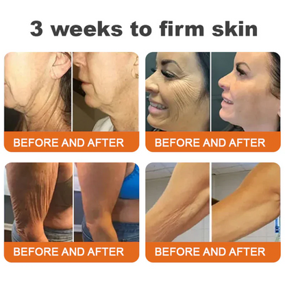 🔥 60% OFF Today Only 🔥 🐝 FDA-Approved BBOJI™ Bee Venom Pro Cream – Clinically Proven to Firm, Lift & Smooth Skin at Any Age 🐝